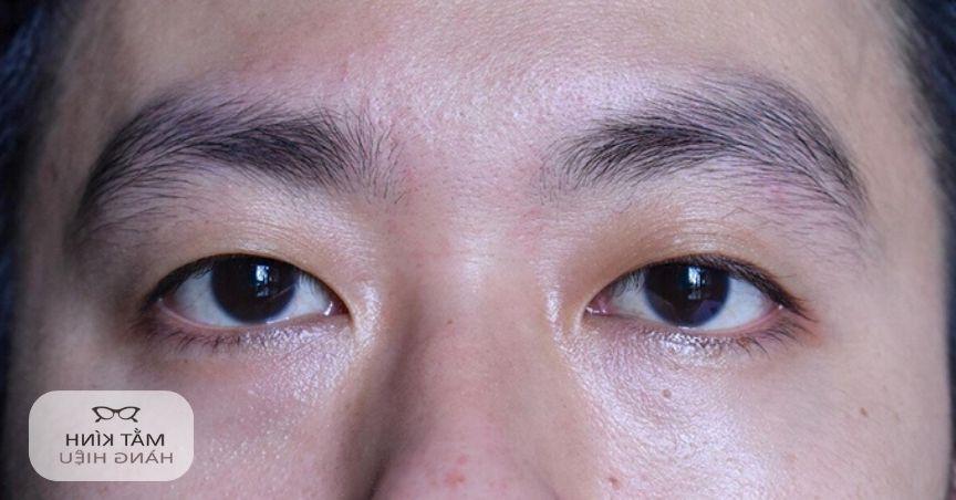 13 các kiểu mắt phổ biến và cách xác định dáng mắt dễ dàng